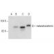 melanotransferrin Antibody (H-11) - Western Blotting - Image 281503