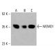 MEMO1 Antibody (AT1E9): sc-517412. Western blot analysis of MEMO1 expression in HeLa (A), K-562 (B) and HCT-116 (C) whole cell lysates. Detection reagent used: m-IgG Fc BP-HRP: sc-525409. MEMO1 Antibody (AT1E9) - Western Blotting - Image 416463