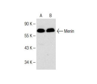 western blotting image from recommended Menin (B-9) monoclonal antibody replacement. Image 150144