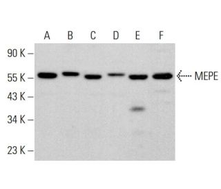 MEPE Antibody (F-7) - Western Blotting - Image 382209
