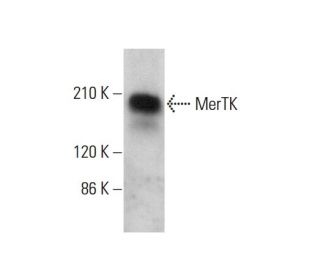 MerTK Antibody (348) - Western Blotting - Image 377488