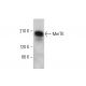 MerTK Antibody (348) - Western Blotting - Image 377488