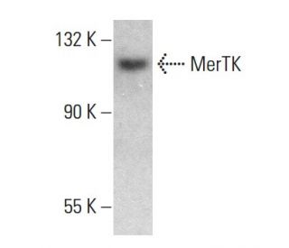 MerTK Antibody (A311) - Western Blotting - Image 377641