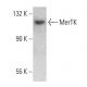 MerTK Antibody (A311) - Western Blotting - Image 377641