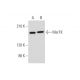 MerTK Antibody (B-4) - Western Blotting - Image 345944