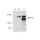 This polyclonal antibody has been discontinued. See our recommended <a href="mertk-antibody-b-1">MerTK (B-1)</a> monoclonal antibody (sample data shown). western blotting image from recommended MerTK (B-1) monoclonal antibody replacement. Image 295610