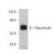 Mesothelin Antibody (B-3) - Western Blotting - Image 355244 