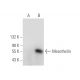 Mesothelin Antibody (C-3) - Western Blotting - Image 68293