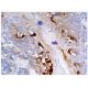 Mesothelin Antibody (G-1) - Immunohistochemistry - Image 160246 