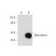 Mesothelin Antibody (G-1) - Western Blotting - Image 133551