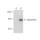 Mesothelin Antibody (G-4) - Western Blotting - Image 72934