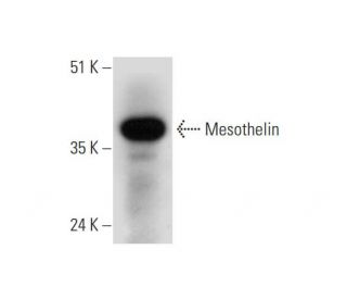 Mesothelin Antibody (G-4) - Western Blotting - Image 325120 