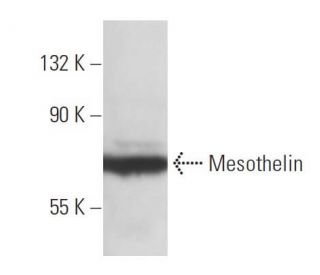 Mesothelin Antibody (K1) - Western Blotting - Image 10911 