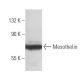 Mesothelin Antibody (K1) - Western Blotting - Image 10911 