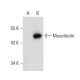 Mesothelin Antibody (K1) - Western Blotting - Image 74526