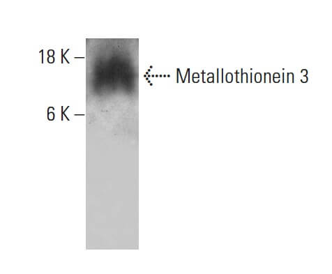 Metallothionein 3 Antibody (1F11) | SCBT - Santa Cruz Biotechnology
