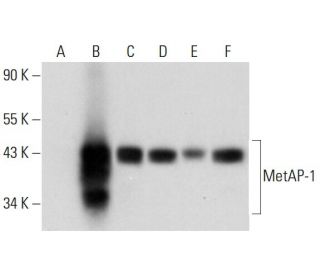 MetAP-1 Antibody (A-2) - Western Blotting - Image 325181 