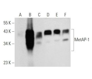 MetAP-1 Antibody (C-12) - Western Blotting - Image 320946 