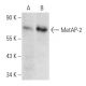 MetAP-2 Antibody (D-1) - Western Blotting - Image 358476 