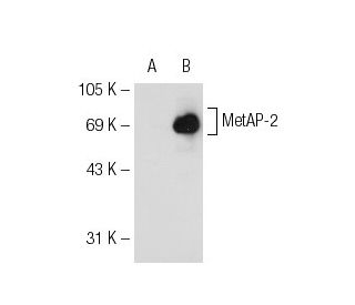 MetAP-2 Antibody (G-5) - Western Blotting - Image 109094 