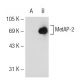 MetAP-2 Antibody (G-5) - Western Blotting - Image 109094 