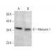 Metaxin 1 Antibody (G-7) - Western Blotting - Image 381096 