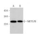METTL7B Antibody (E-10) - Western Blotting - Image 375518 