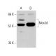 Mex3d Antibody (H-3) - Western Blotting - Image 375581 