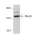 Mex3d Antibody (H-3) - Western Blotting - Image 375589