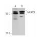 MFAP3L Antibody (4) - Western Blotting - Image 369863
