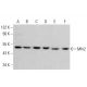 western blotting image from recommended Mfn2/Mitofusin 2 (F-5) monoclonal antibody replacement. Image 378720