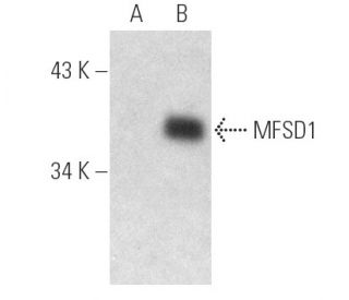 MFSD1 Antibody (A-11) - Western Blotting - Image 388998 