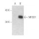 MFSD1 Antibody (A-11) - Western Blotting - Image 388998 