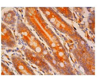 MGAT1 Antibody (H-6) - Immunohistochemistry - Image 313910 
