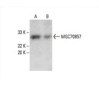 MGC70857 Antibody (D-1) - Western Blotting - Image 392986 