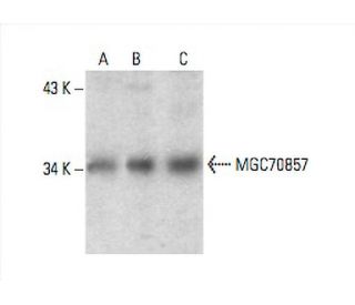 MGC70857 Antibody (G-5) - Western Blotting - Image 392982 