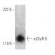 mGluR-5 Antibody (1B3) - Western Blotting - Image 366690