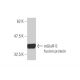 western blotting image from recommended mGluR-5 (1B3) monoclonal antibody replacement. Image 348510