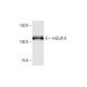 mGluR-6 Antibody (1A11) - Western Blotting - Image 352117 