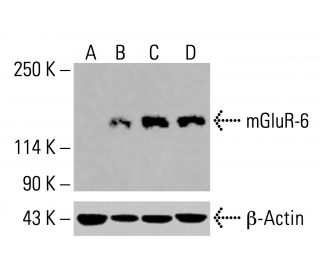 mGluR-6 Antibody (1A11) - Western Blotting - Image 416138 