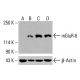 mGluR-6 Antibody (1A11) - Western Blotting - Image 416138 