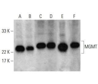 MGMT Antibody (E-1) - Western Blotting - Image 380970 