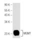 MGMT Antibody (E-6) - Western Blotting - Image 81194 