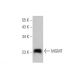 MGMT Antibody (E-6) - Western Blotting - Image 350811