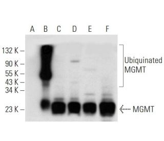 MGMT Antibody (F-5) - Western Blotting - Image 318022 