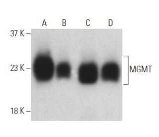 MGMT Antibody (MT 3.1) - Western Blotting - Image 398876 