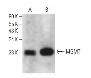 MGMT Antibody (SPM287) - Western Blotting - Image 379180 