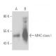 MHC class I Antibody (ER-HR52) - Western Blotting - Image 17059