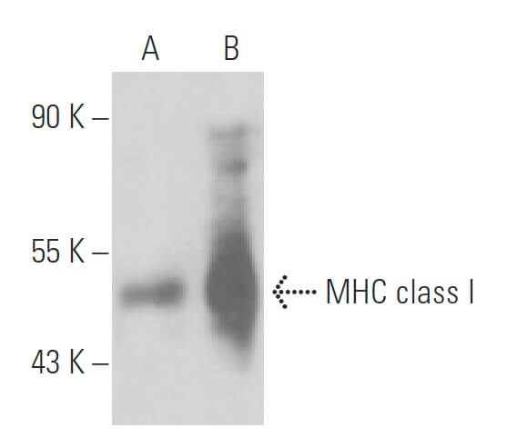 Anti-MHC Class I Antibody (ER-HR52) | SCBT - Santa Cruz Biotechnology