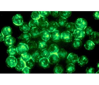 MHC class I Antibody (W6/32) - Immunofluorescence - Image 12126 